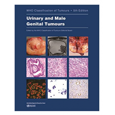 WHO S Classification Of Tumours Female Genital Tumours Th Edition By World Health